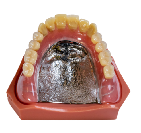 ❷ チタン床義歯
